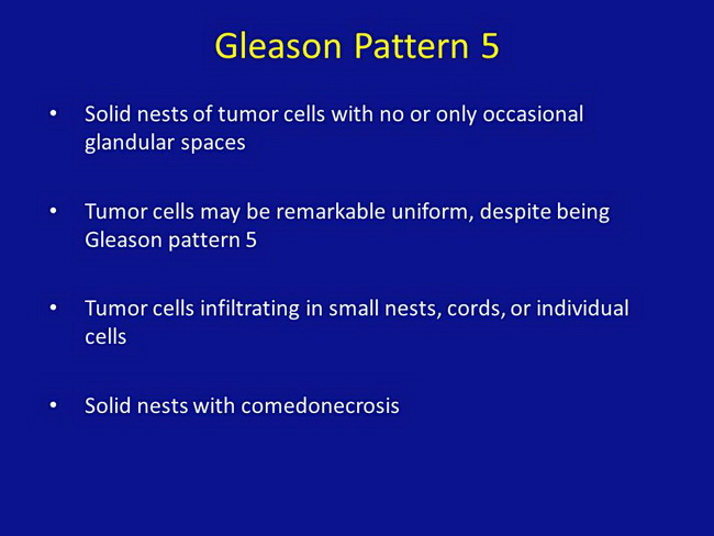 Gleason Pattern 5_Resized.jpg
